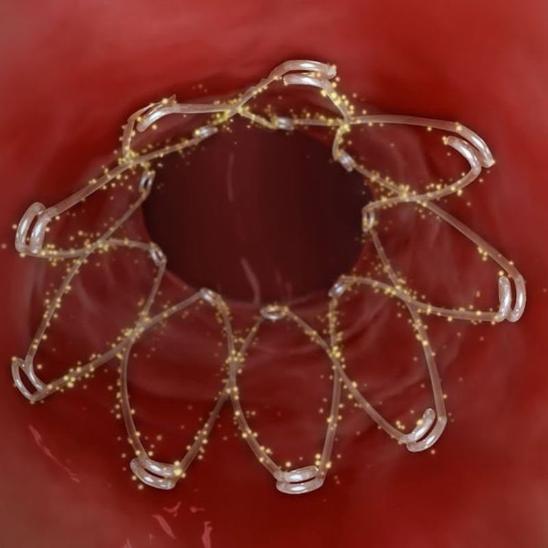 Propel Mini Medtronic